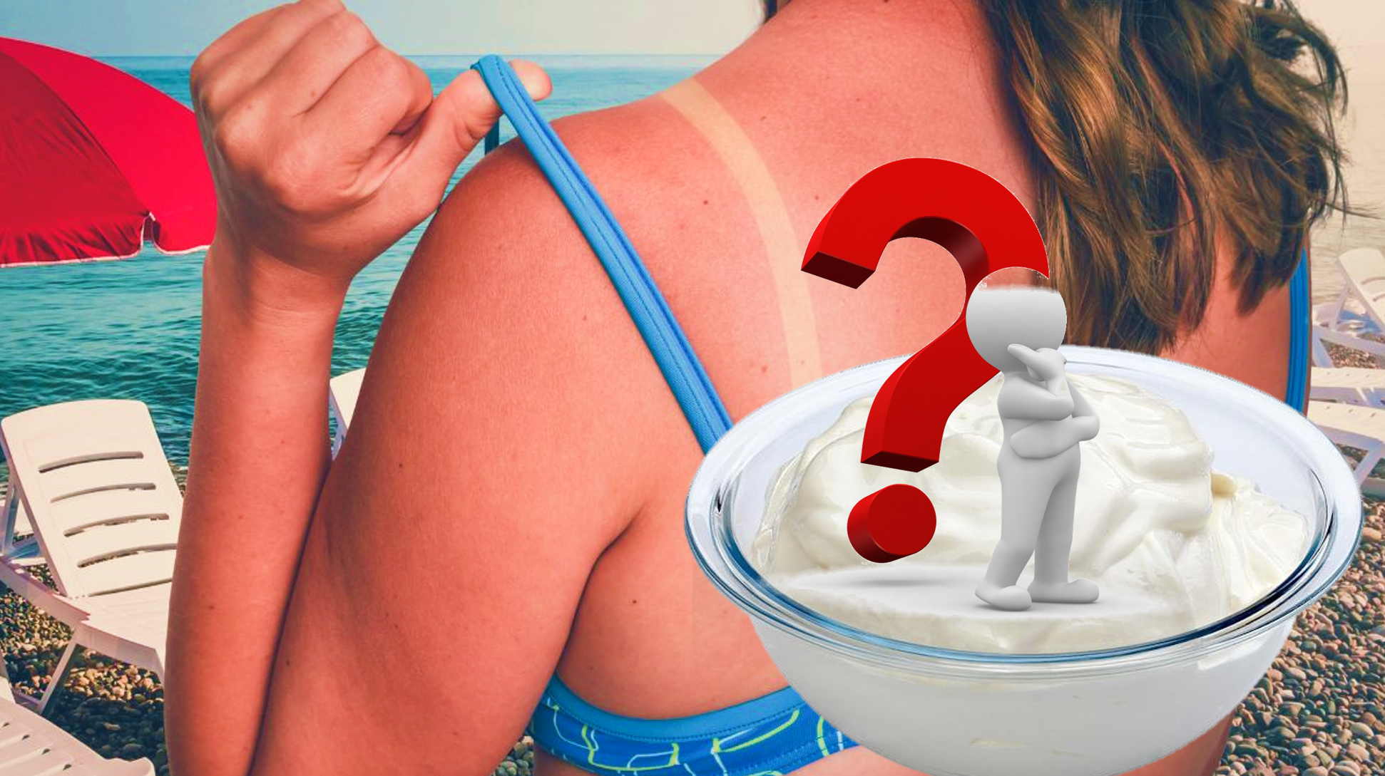 Napégésre használj tejföl helyett antioxidánsokat!