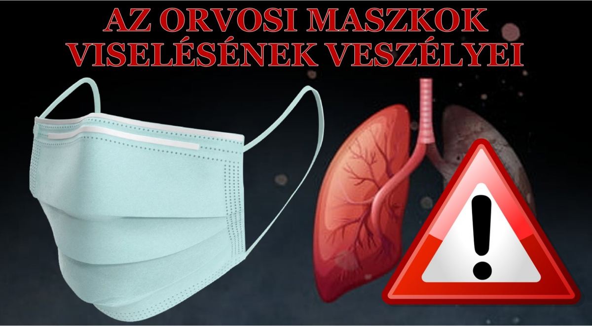 Mi a helyzet a maszkokkal?